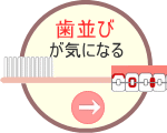 歯並びが気になる